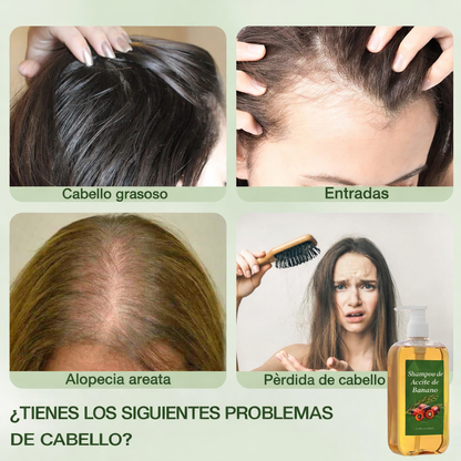 Batana Vital - Champú Fortalecedor Capilar Anticaída